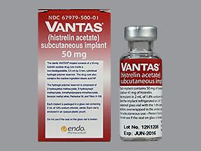 VANTAS Implant